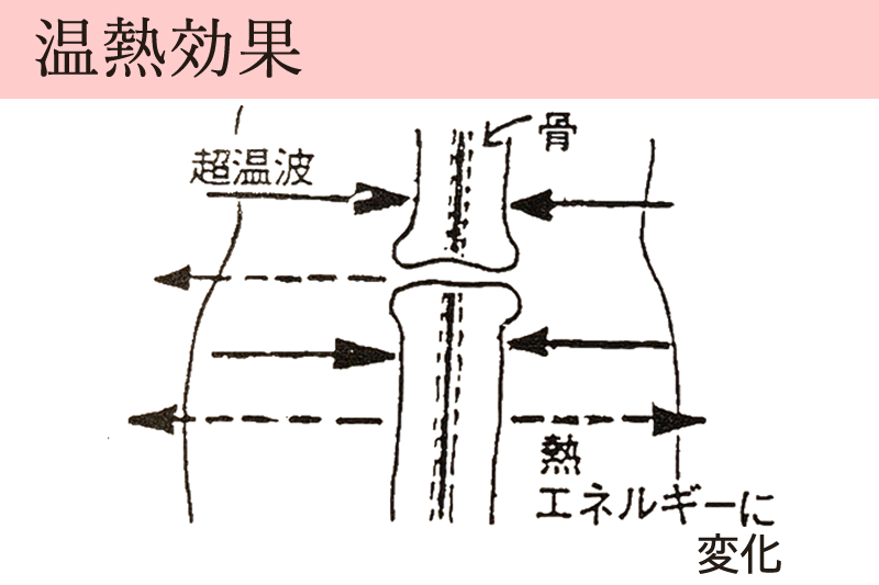 温熱効果